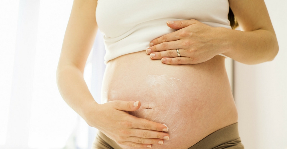 How To Prevent Stretch Marks During Pregnancy
