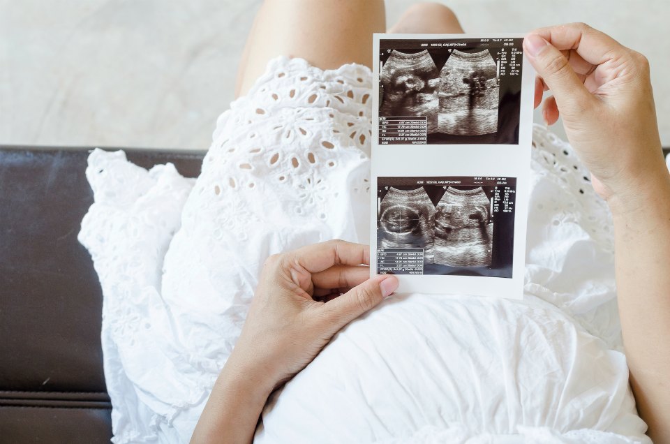 Close up of pregnant woman holding ultrasound scan