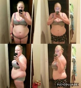 Dusty-Skye-20kgs-weight-loss-before-after