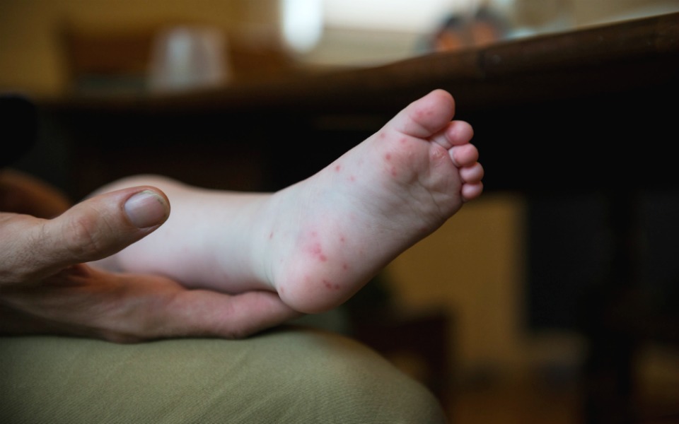 14 Newborn Rashes You Need To Know About