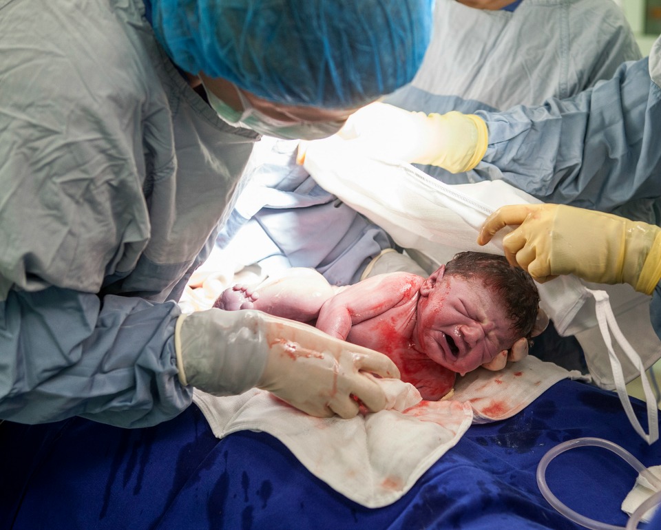 Midwife-led care helps reduces the rate of unnecessary c-section births, study finds