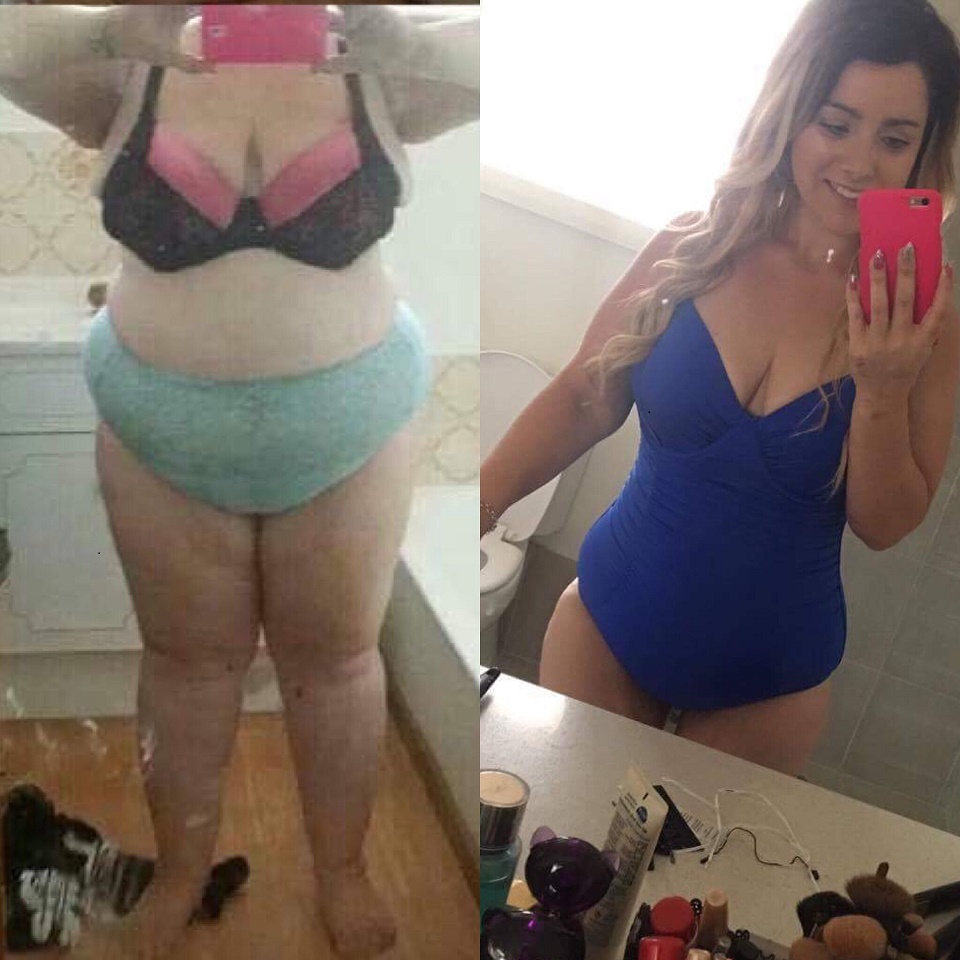 Crystle-before-after-50kgs-weight-loss