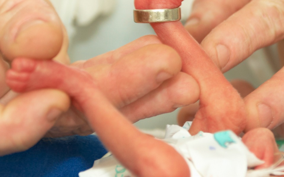 wow twins born at 23 weeks were so small they fit in mums hand size of 23 week fetus