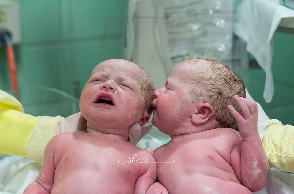 twin births