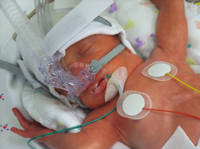 BREAKTHROUGH: Artificial Wombs Could Save Extremely Premature Babies