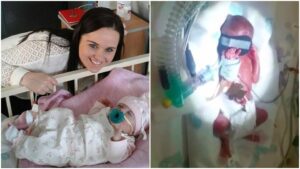 Baby born 23 weeks proves doctors wrong