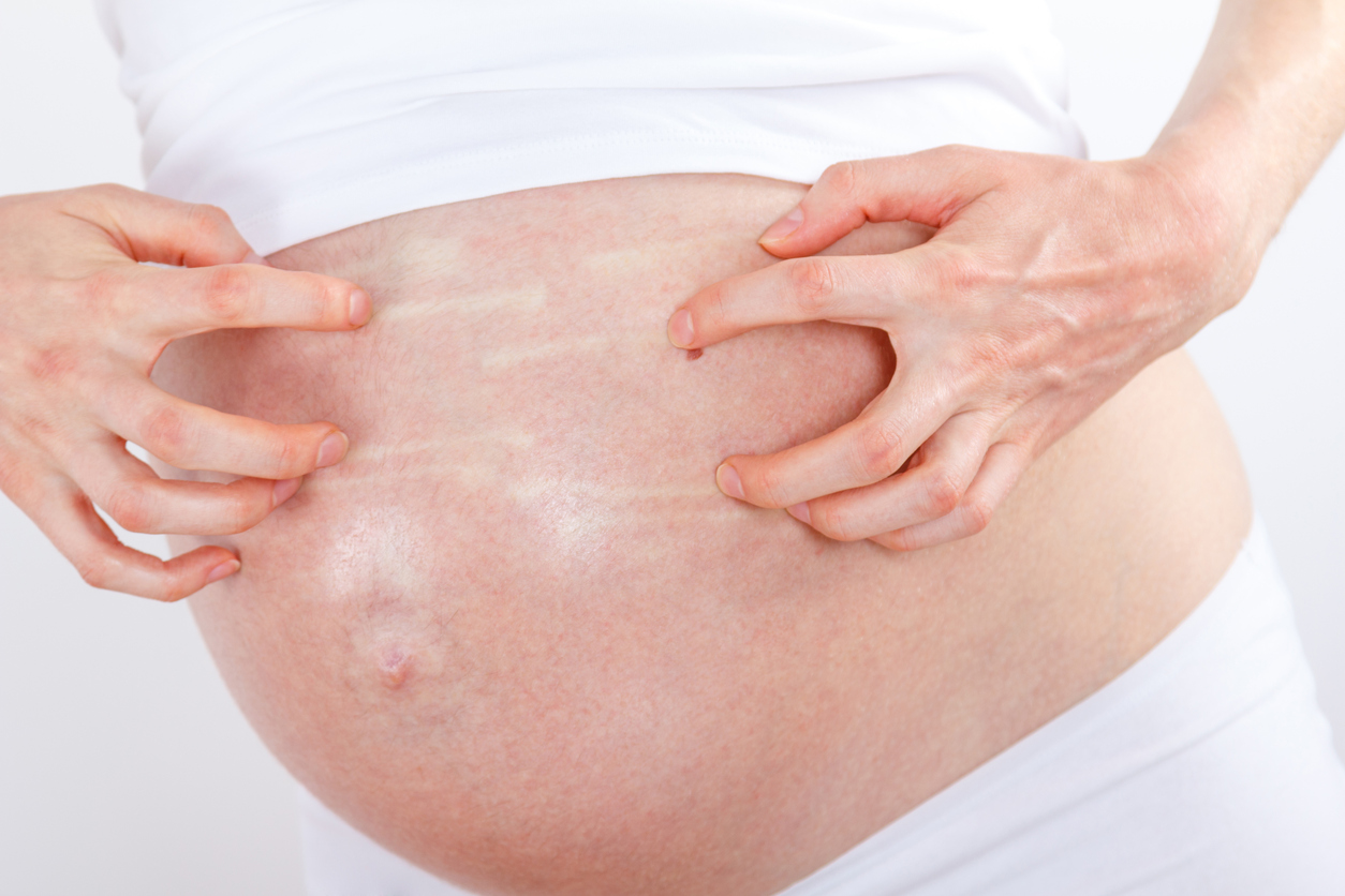 Itching of the skin of the abdomen of a pregnant woman