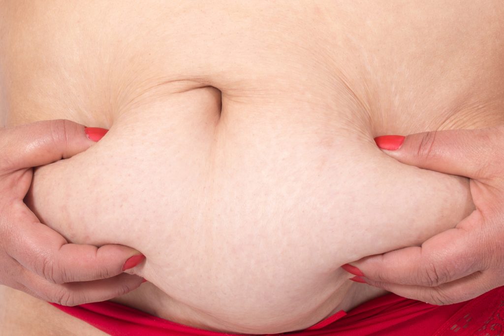 Woman fat belly