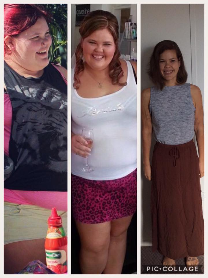 Zoe is unrecognisable after her unbelievable 52kg weight loss! zoe lee molloy