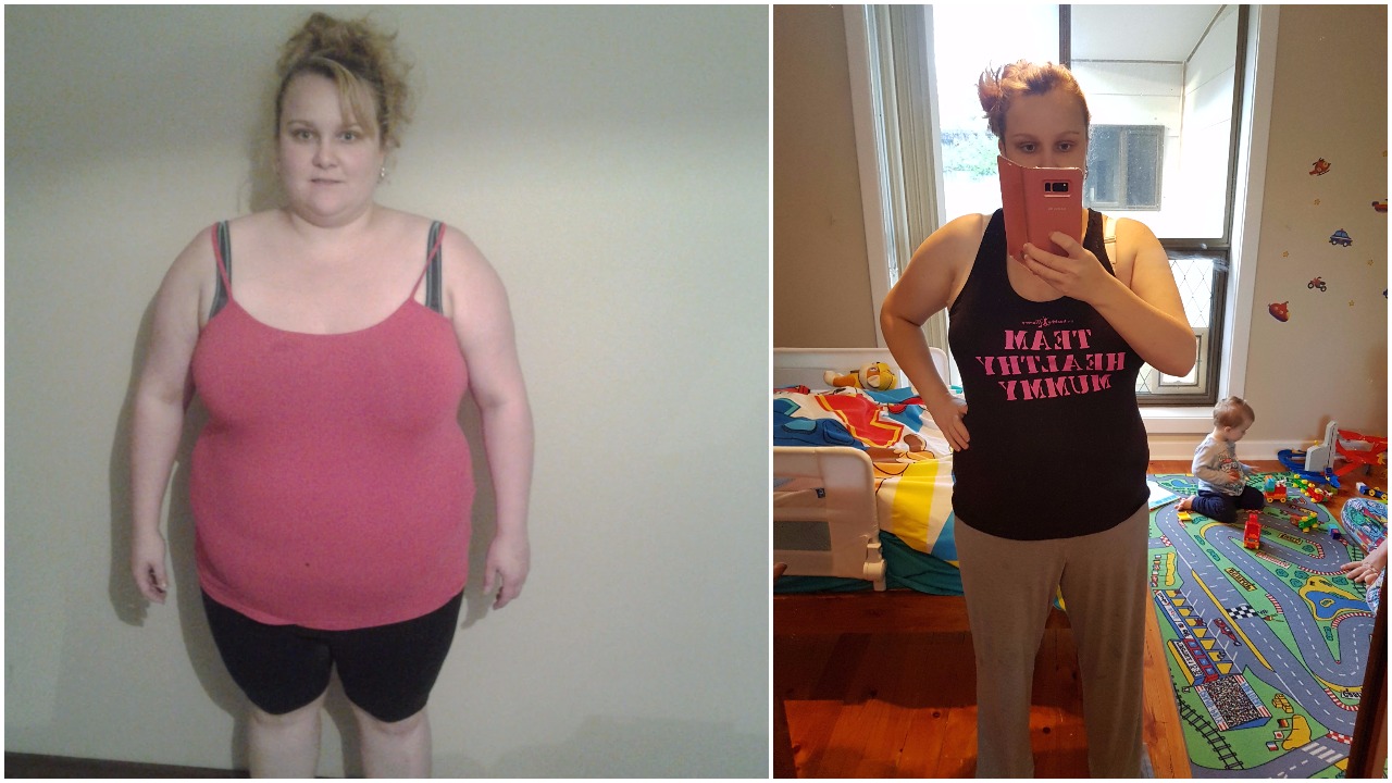 how to lose weight with pcos and endometriosis