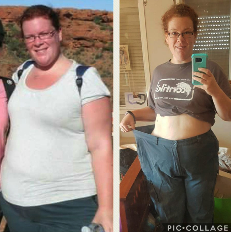 Sandra weight loss story