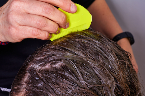 lice head chemical resistance treatments developed hair rid