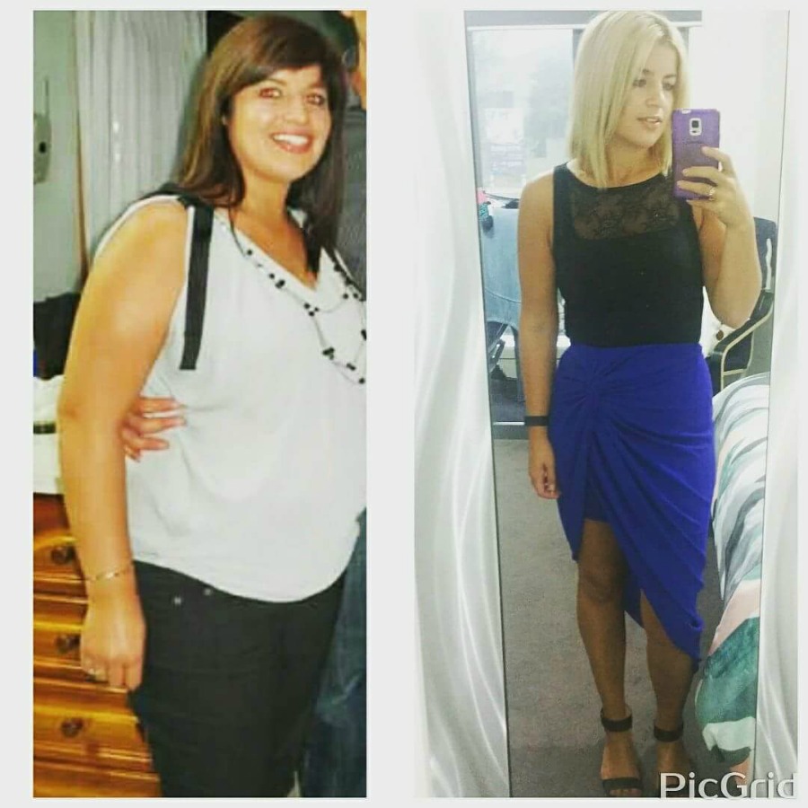 annette-before-after