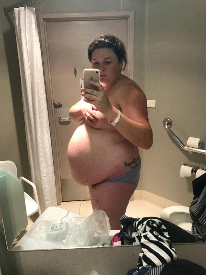 5 Real Mums Proudly Share Pics Of Their Body One Week After Giving Birth