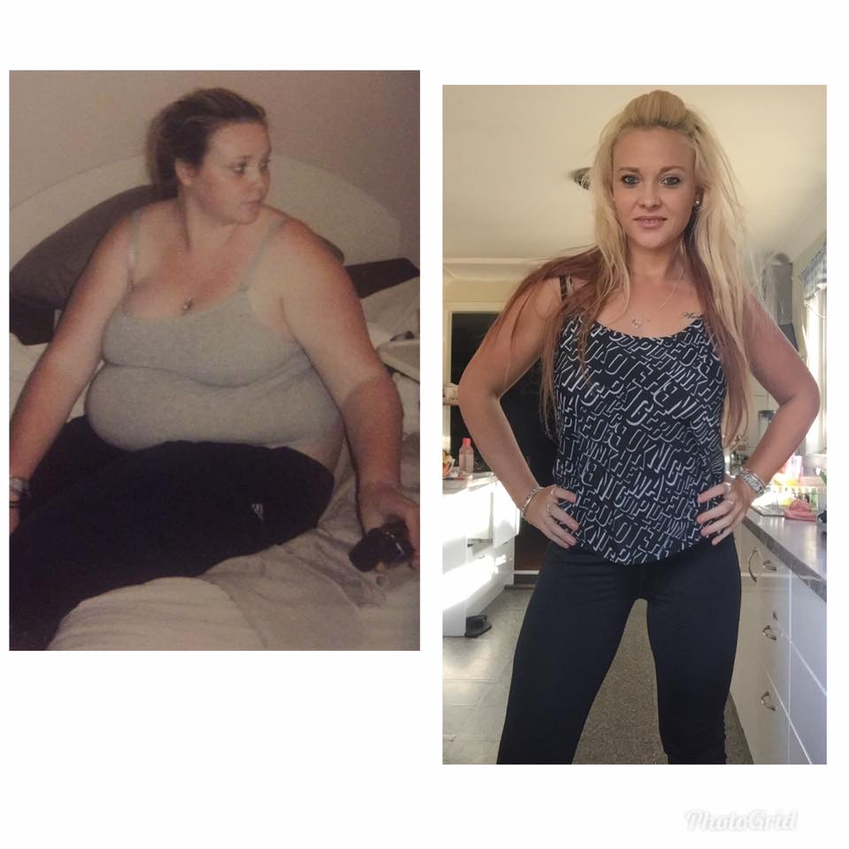 Stacey Chisholm before and after