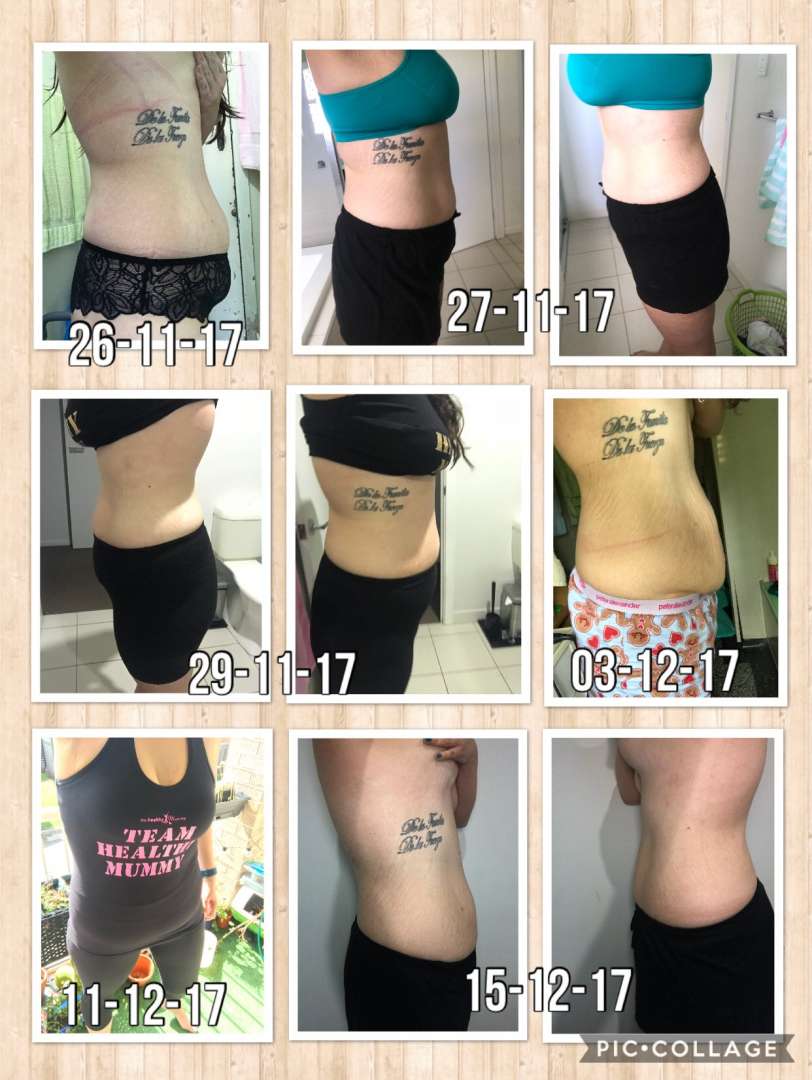 This mum tells "how I lost my belly fat and cm from my body" Melanie Arnold-Stemm compilation of belly progress