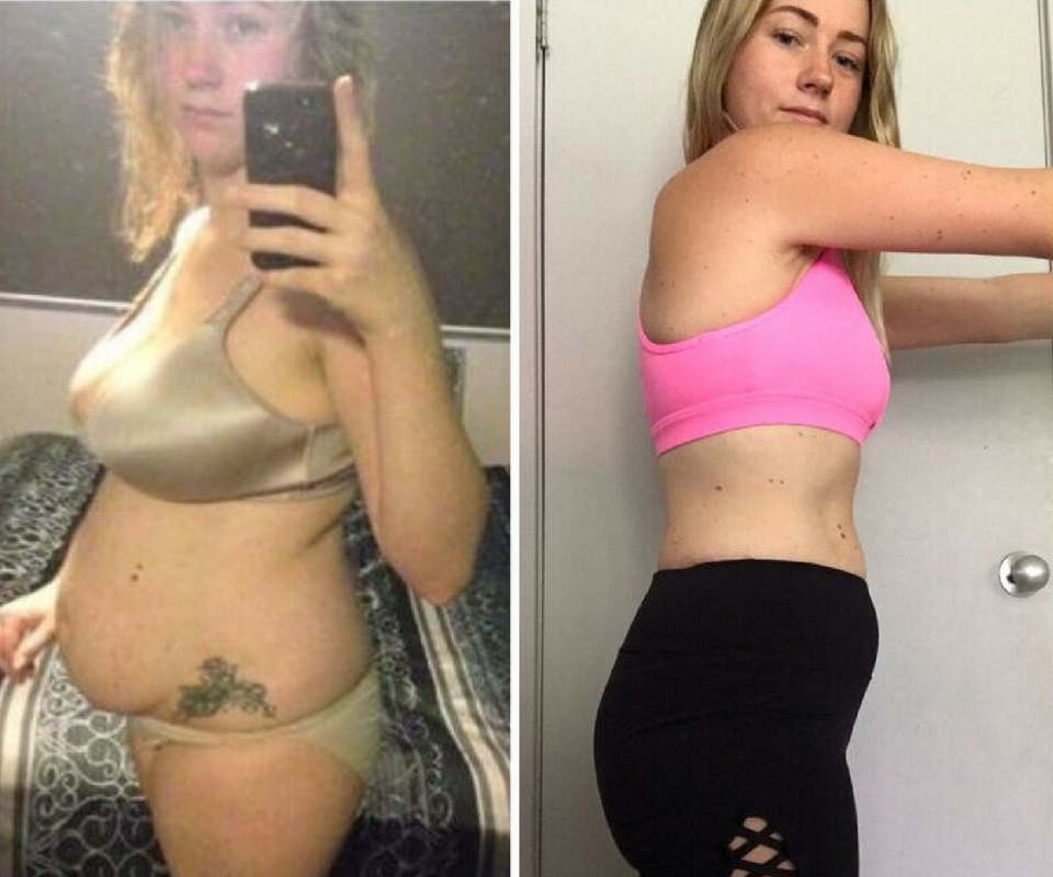 Kaitie Purssell showing her before and after picture.