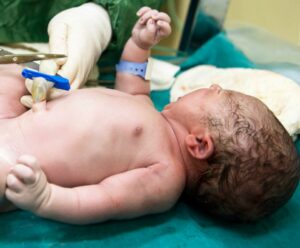 How long it takes for your newborn’s umbilical cord to fall off and how to care for it