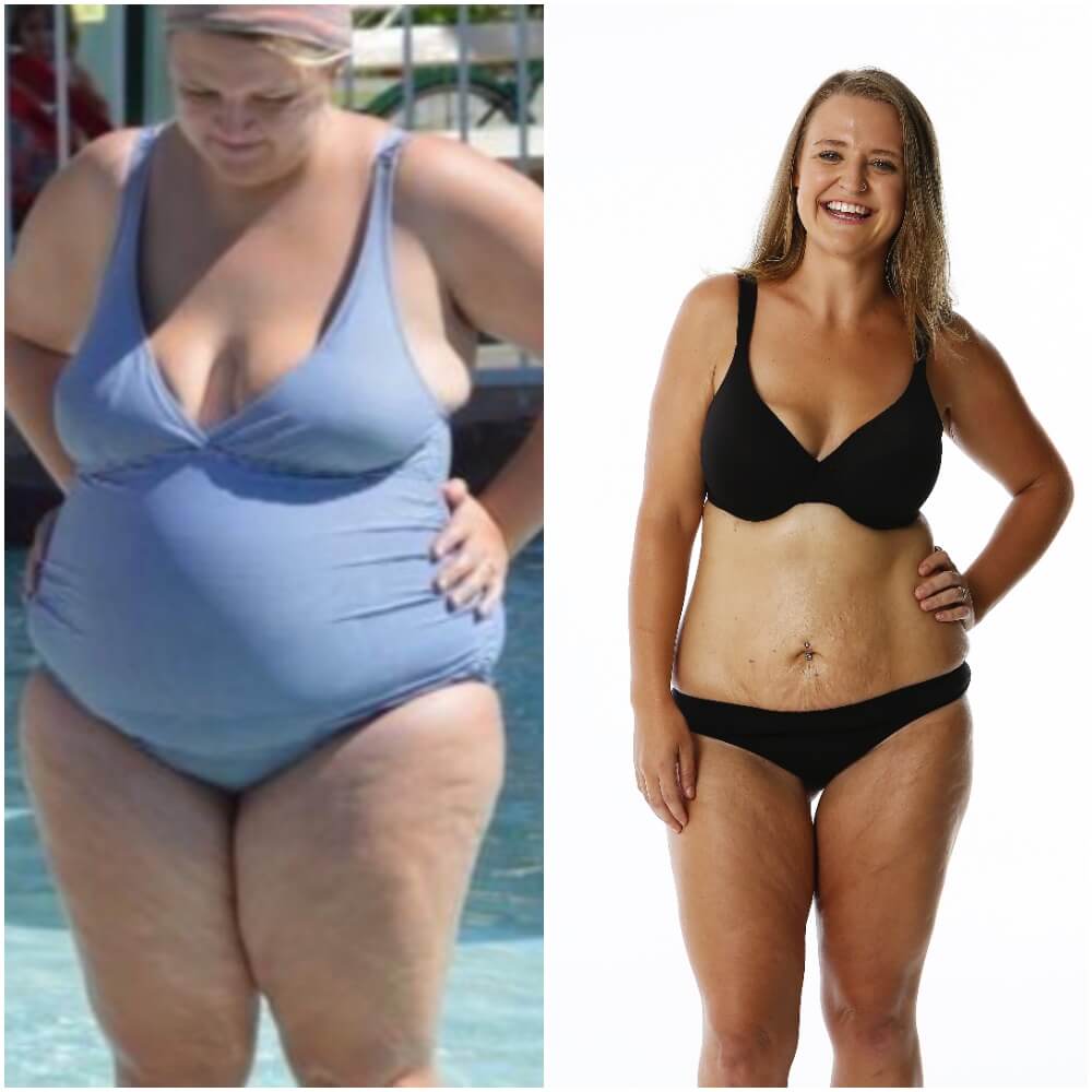 fat stomach swimsuit