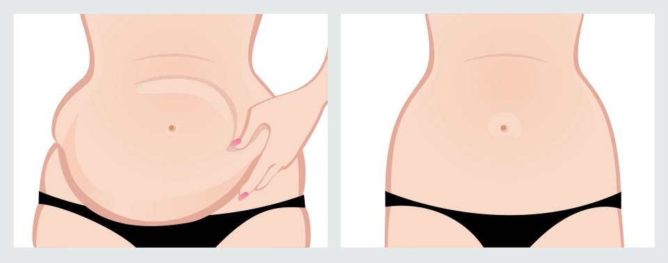 14 different causes of excess belly fat in women what causes belly fat in females