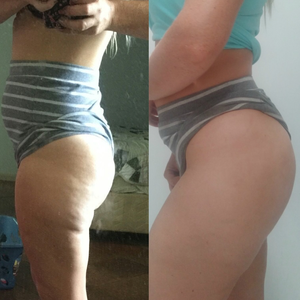 banish-cellulite-gemma-bath-before-after.001