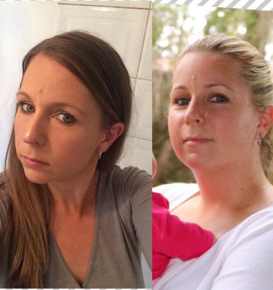 Andrea Hutton face transformation