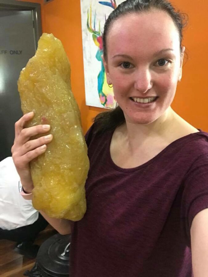 Lose 2kg in a week - what 2kg of fat looks like
