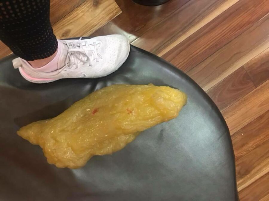 What 2kg of fat looks like - How to lose 2kg in a week