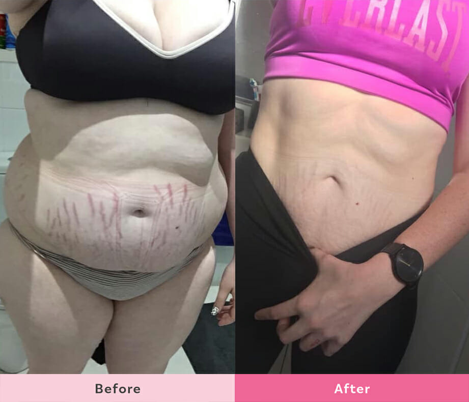 Nikita's amazing tummy transformation