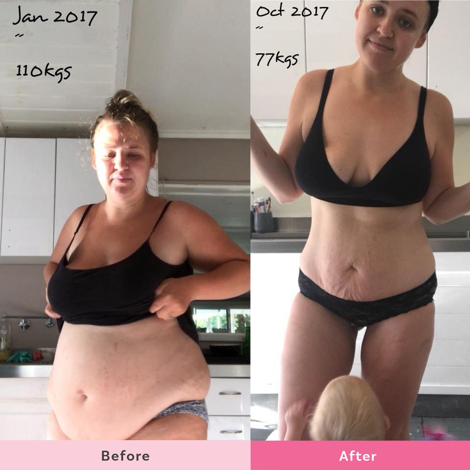 Losing sales postpartum belly