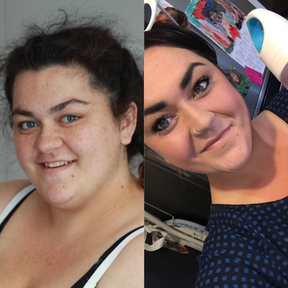 Ashleigh-Anning-30kg-weight-loss-12-months-2