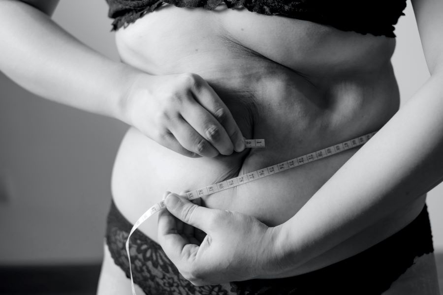 what does a pcos belly look like