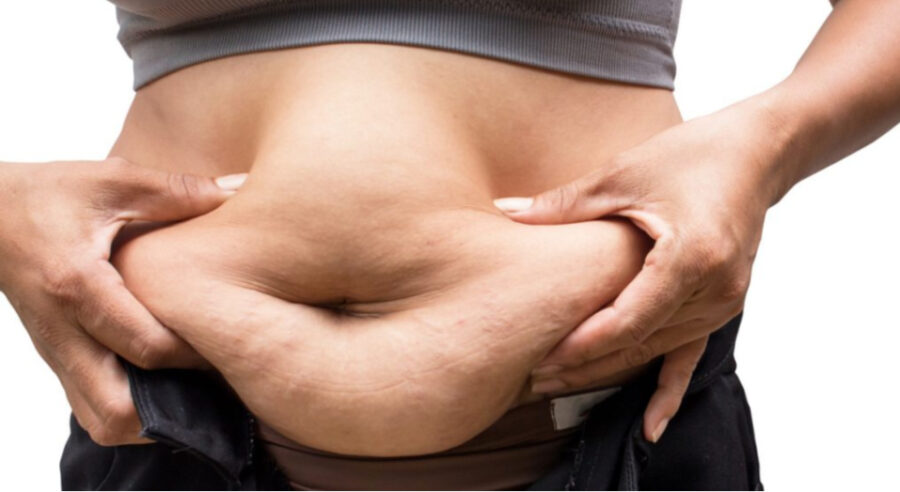 What Is Water Weight? Causes, Symptoms & How to Flush It Naturally