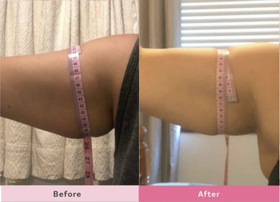 Amy-Thomson-SKIN-Body-Sculpting-Lotion-Results-3months-2