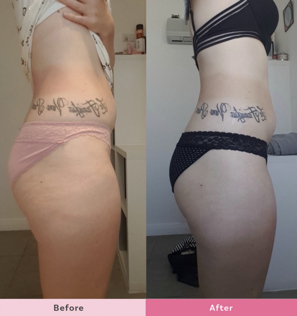 Kate-Jacklin-SKIN-Body-Sculpting-Lotion-Results-1-week