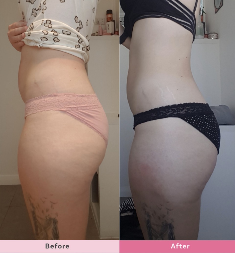 Kate-Jacklin-SKIN-body-sculpting-lotion-results-2-weeks-1