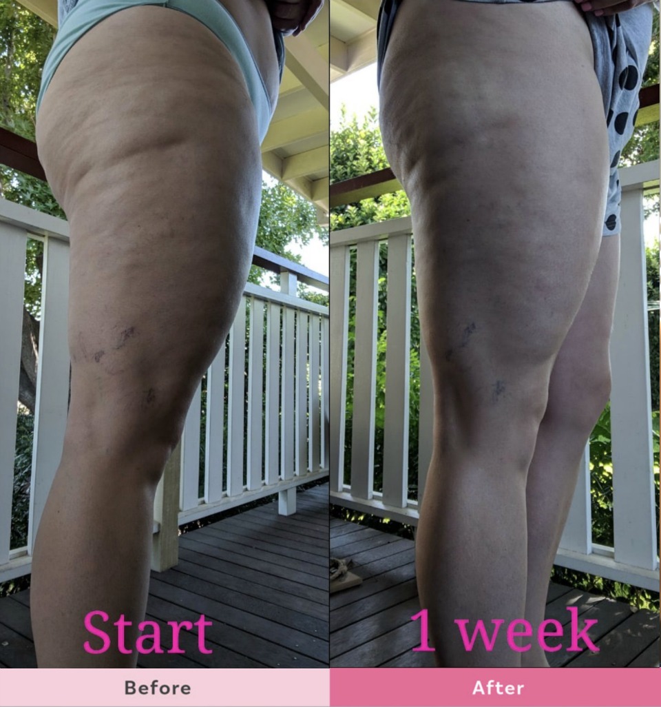 Lauren-Kolstad-SKIN-Body-Sculpting-Lotion-results-1-week.