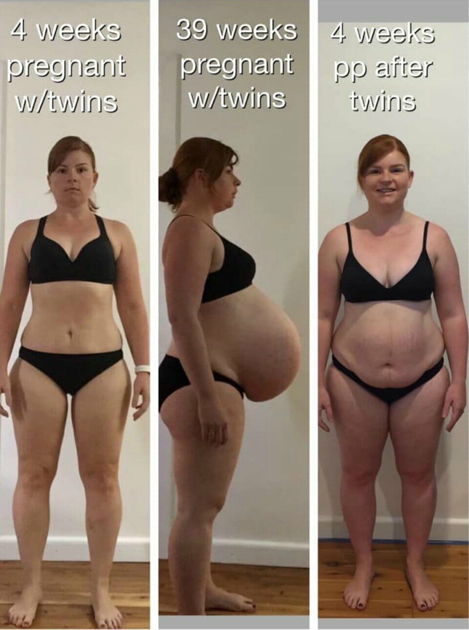 Stacey-Webb-twin-pregnancy-progress