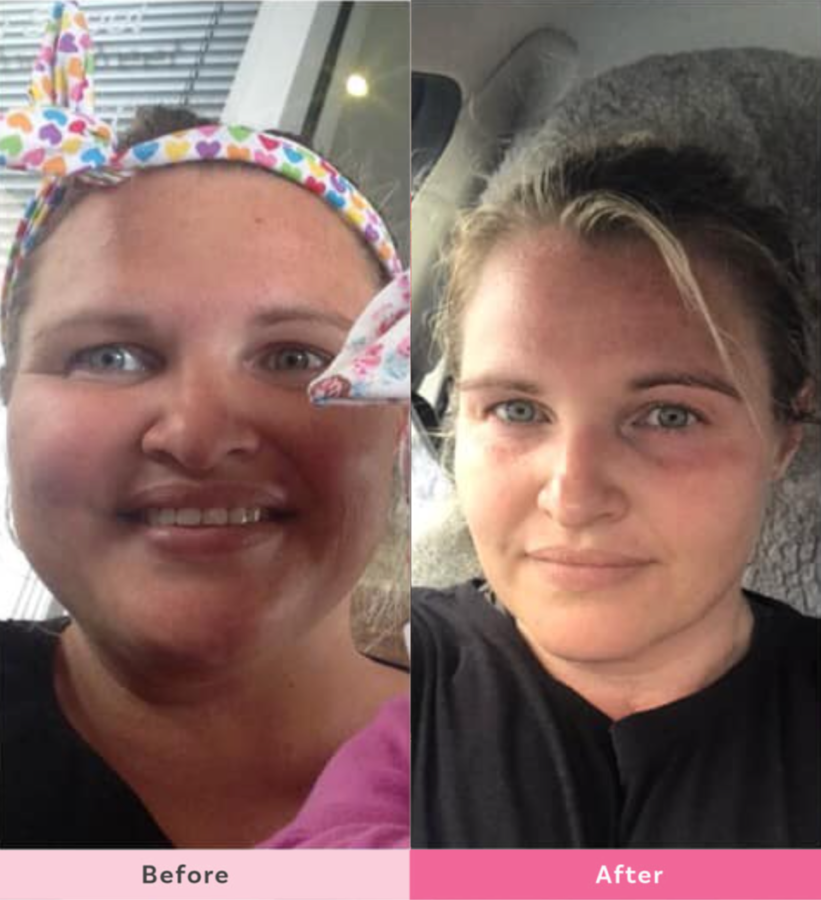 Tanya-Priest-before-after-face-comparison-weight-loss