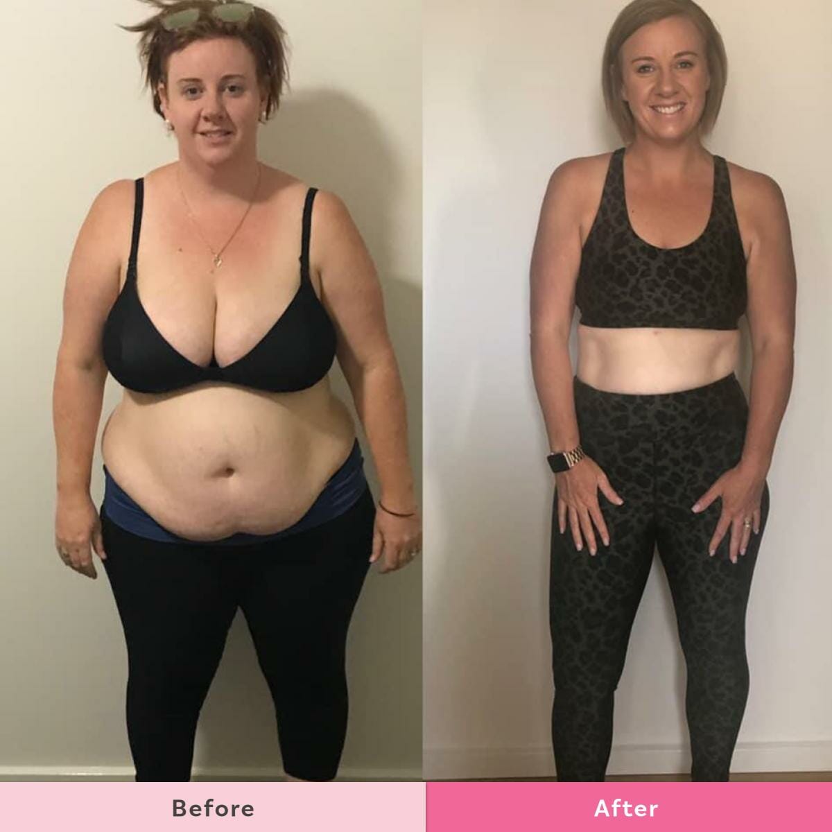 Belly Fat Before And After Women