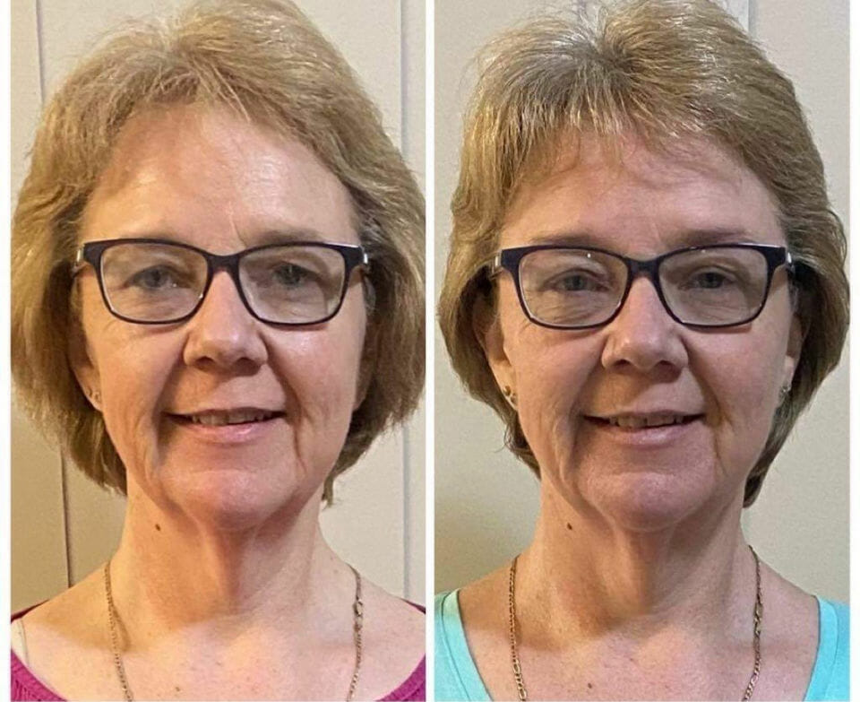 How this mum made her face look years younger WITHOUT any surgery!