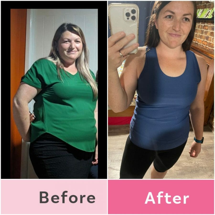 Do You Experience Weight Loss After Breast Reduction Procedure?